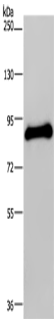 Western Blot analysis of Human testis tissue using POMT1 Polyclonal Antibody at dilution of 1:200