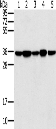 Western Blot analysis of Jurkat, 293T and hela cell, Mouse brain tissue and K562 cell using PPP1CC Polyclonal Antibody at dilution of 1:200
