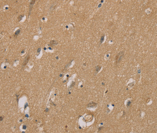 Immunohistochemistry of paraffin-embedded Human brain using RAD51 Polyclonal Antibody at dilution of 1:40