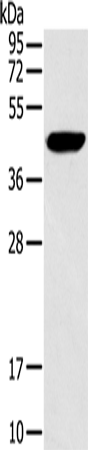 Western Blot analysis of Hela cell using RAD51 Polyclonal Antibody at dilution of 1:200