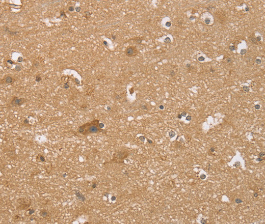 Immunohistochemistry of paraffin-embedded Human brain  tissue using RNF148 Polyclonal Antibody at dilution 1:40