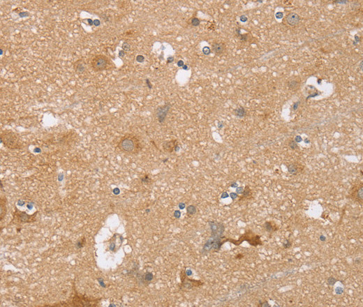 Immunohistochemistry of paraffin-embedded Human brain  using TRIM34 Polyclonal Antibody at dilution of 1:30