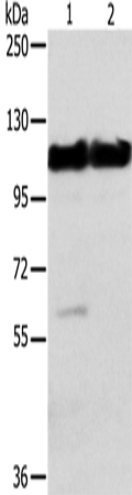 Western Blot analysis of Mouse heart and muscle tissue using ACTN2 Polyclonal Antibody at dilution of 1:200