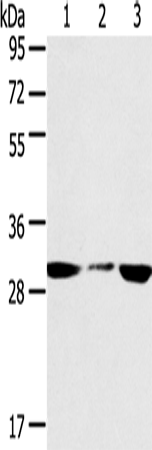 Western Blot analysis of PC3 and hepg2 cell, Human fetal liver tissue using SDHB Polyclonal Antibody at dilution of 1:400