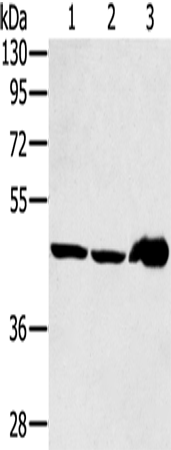 Western Blot analysis of Mouse liver tissue and PC3 cell, Human fetal liver tissue using SEC14L2 Polyclonal Antibody at dilution of 1:400