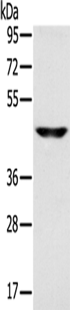 Western Blot analysis of Human fetal brain tissue using SLC16A8 Polyclonal Antibody at dilution of 1:200