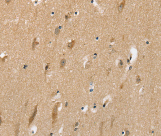 Immunohistochemistry of paraffin-embedded Human brain tissue using SLC6A7 Polyclonal Antibody at dilution 1:30