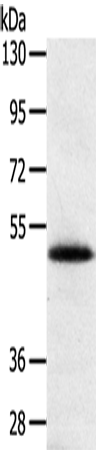 Western Blot analysis of Human placenta tissue using SMOC2 Polyclonal Antibody at dilution of 1:250