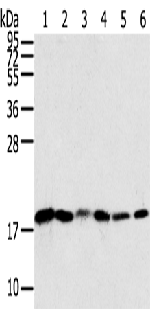 Western Blot analysis of Human colon sigmoideum cancer and colon cancer tissue, Mouse lung and Human normal colon tissue, lovo and hela cell using SNX3 Polyclonal Antibody at dilution of 1:250