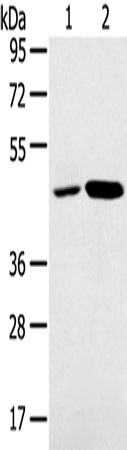 Western Blot analysis of K562 and Jurkat cell using SNX5 Polyclonal Antibody at dilution of 1:250