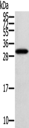 Western Blot analysis of Human fetal brain tissue using STARD5 Polyclonal Antibody at dilution of 1:400