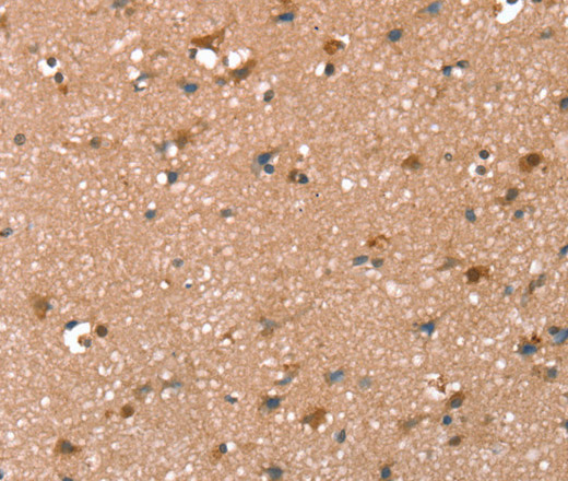 Immunohistochemistry of paraffin-embedded Human brain tissue using SYNPO2 Polyclonal Antibody at dilution 1:50