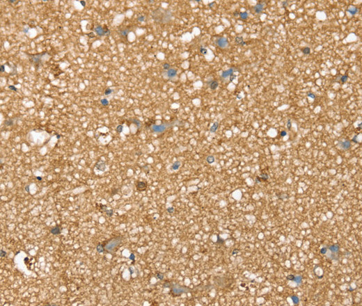 Immunohistochemistry of paraffin-embedded Human brain tissue using SDC3 Polyclonal Antibody at dilution 1:45