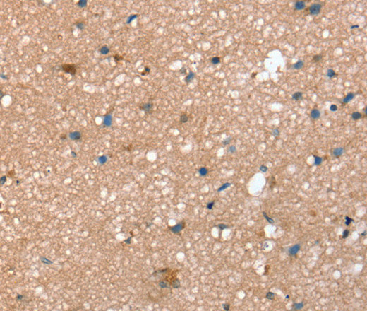 Immunohistochemistry of paraffin-embedded Human brain  using STX2 Polyclonal Antibody at dilution of 1:40