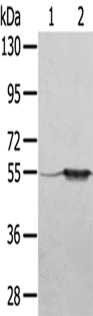 Western Blot analysis of A375 cell and Human fetal muscle tissue using TRIM35 Polyclonal Antibody at dilution of 1:550