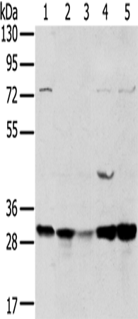 Western Blot analysis of 293T and MCF7 cell, Mouse brain tissue and K562 cell, Mouse bladder tissue using TPD54 Polyclonal Antibody at dilution of 1:400