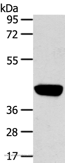 Western Blot analysis of Hepg2 cell using PRSS50 Polyclonal Antibody at dilution of 1:450