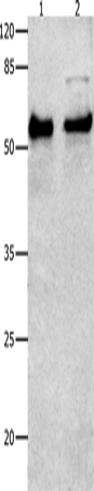 Western Blot analysis of Human liver cancer tissue and Hela cells using SMAD4 Polyclonal Antibody at dilution of 1:150