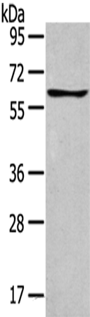 Western Blot analysis of Jurkat cells using GLP2R Polyclonal Antibody at dilution of 1:400