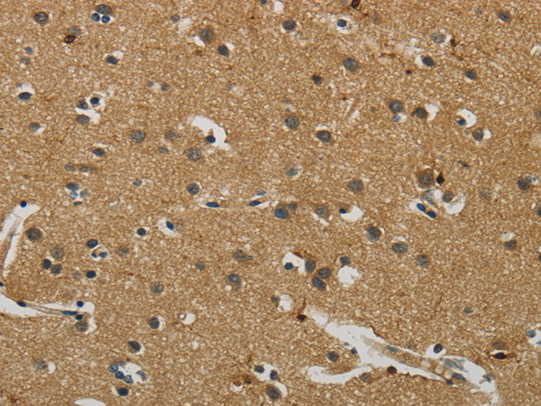 Immunohistochemistry of paraffin-embedded Human brain tissue using AIF1 Polyclonal Antibody at dilution 1:50