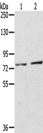 Western Blot analysis of A172 cells and Mouse liver tissue using ECE2 Polyclonal Antibody at dilution of 1/350