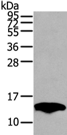 Western Blot analysis of Mouse fat tissue using PMP2 Polyclonal Antibody at dilution of 1/400