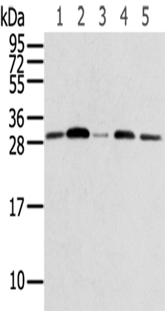 Western Blot analysis of 231, Jurkat, A549, huvec and Hela cells using RPA2 Polyclonal Antibody at dilution of 1/600