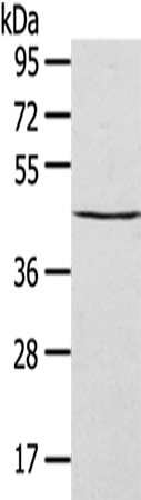 Western Blot analysis of HepG2 cells using SEPT2 Polyclonal Antibody at dilution of 1/400