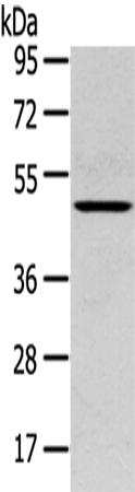 Western Blot analysis of Mouse lung tissue using SERPINB11 Polyclonal Antibody at dilution of 1/400