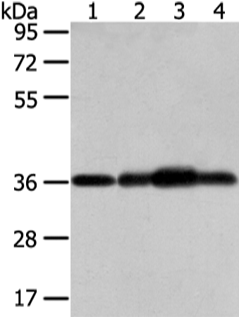 Western Blot analysis of Mouse brain tissue, hepg2, 293T and 231 cell using STX12 Polyclonal Antibody at dilution of 1/800