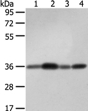 Western Blot analysis of 231, 293T and hepg2 cell, Mouse brain tissue using STX12 Polyclonal Antibody at dilution of 1/400