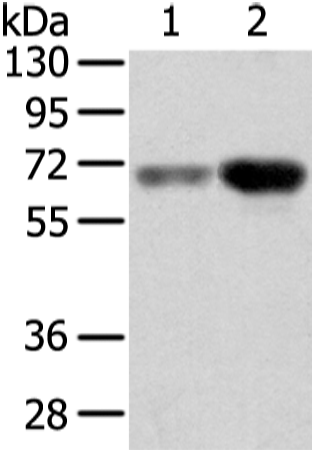 Western Blot analysis of Human lung cancer and placenta tissue using TBL1X Polyclonal Antibody at dilution of 1/500