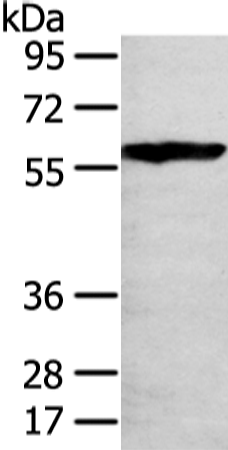 Western Blot analysis of 293T cell using THAP4 Polyclonal Antibody at dilution of 1/250