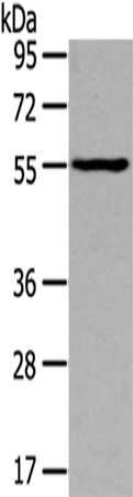 Western Blot analysis of Mouse muscle tissue using THRA Polyclonal Antibody at dilution of 1/400