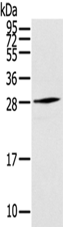 Western Blot analysis of Human fetal muscle tissue using THYN1 Polyclonal Antibody at dilution of 1/800