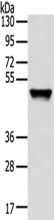 Western Blot analysis of Human fetal liver tissue using TRIM14 Polyclonal Antibody at dilution of 1/800