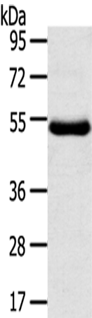 Western Blot analysis of Human thigh malignant fibrous histiocytoma tissue using TMPRSS11D Polyclonal Antibody at dilution of 1/800