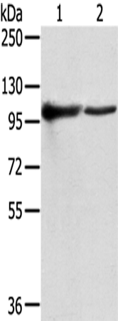 Western Blot analysis of K562 and A431 cells using TPX2 Polyclonal Antibody at dilution of 1/800