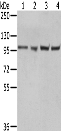 Western Blot analysis of A431, 293T, Hela and K562 cells using TPX2 Polyclonal Antibody at dilution of 1/800