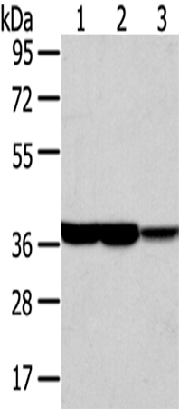 Western Blot analysis of Human fetal brain and placenta tissue, Mouse brain tissue using TALDO1 Polyclonal Antibody at dilution of 1/400