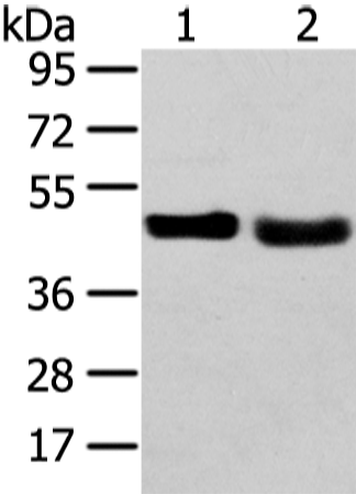 Western Blot analysis of 231 cell and Human fetal liver tissue using TRIB2 Polyclonal Antibody at dilution of 1/450