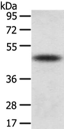 Western Blot analysis of Mouse adrenal gland tissue using TTC23 Polyclonal Antibody at dilution of 1/800