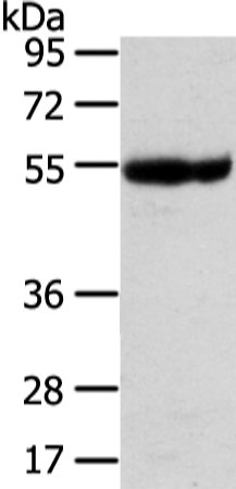 Western Blot analysis of Human placenta tissue using UBAP1 Polyclonal Antibody at dilution of 1/400