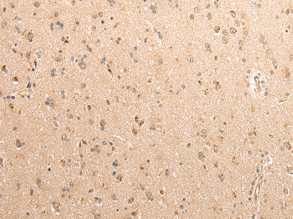 Immunohistochemistry of paraffin-embedded Human brain using SDCBP Polyclonal Antibody at dilution of  1/40