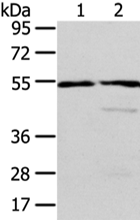 Western Blot analysis of Human normal liver and fetal liver tissue using ALDH3A2 Polyclonal Antibody at dilution of 1/250