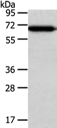 Western Blot analysis of Hepg2 cell using USP39 Polyclonal Antibody at dilution of 1/400