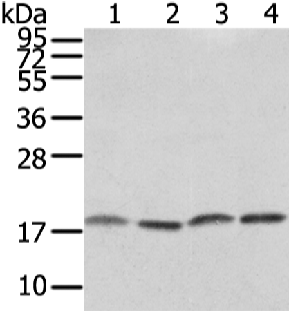 Western Blot analysis of PC3, TM4, hela and K562 cell using VAMP4 Polyclonal Antibody at dilution of 1/650