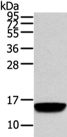 Western Blot analysis of Human normal prostate tissue using VAMP5 Polyclonal Antibody at dilution of 1/650