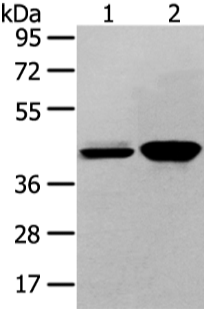 Western Blot analysis of Hela and 293T cell using VASH2 Polyclonal Antibody at dilution of 1/450