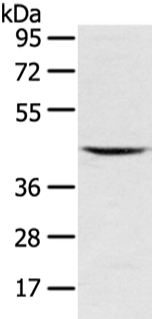 Western Blot analysis of Mouse kidney tissue using VSIG8 Polyclonal Antibody at dilution of 1/400